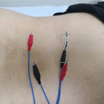 01_acupuncteur_acupuncture_Tournai_Hainaut_Belgique_sebastien_maes_techniques_stages_clinique_Shangai_IMG_20190717_090349